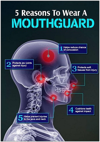 5 reasons to wear a mouthguard - Copy